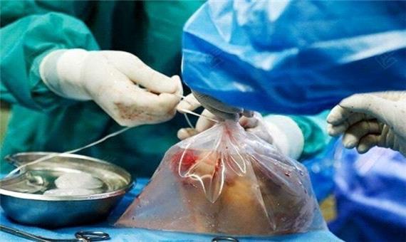 اهدای عضو بیمار مرگ مغزی در یزد به یک نفر زندگی دوباره بخشید