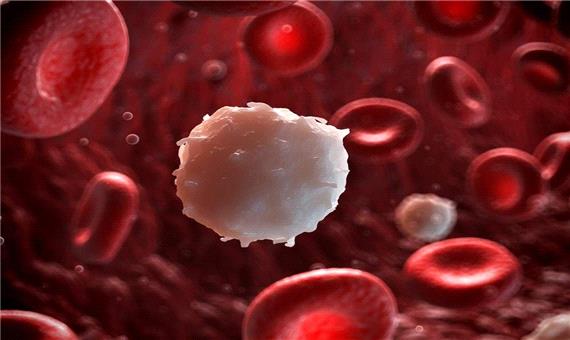 فوق تخصص خون: یزد در رتبه نخست پرخطرترین استان‌های سرطانی قرار دارد