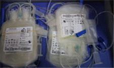 افزایش نیاز به اهدا کننده و تجهیزات انتقال خون در استان یزد