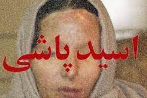 درخواست مهریه از شوهر بعد از اسید پاشی روی خواهر شوهر