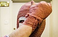 سوختگی دو جوان در میبد بر اثر انفجار ترقه