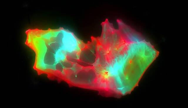 کشف ساختارهای عجیب و غریب در خون افراد مبتلا به کووید طولانی‌مدت